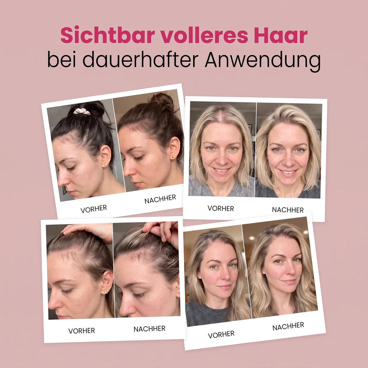 Velura Haarwachstums-Shampoo